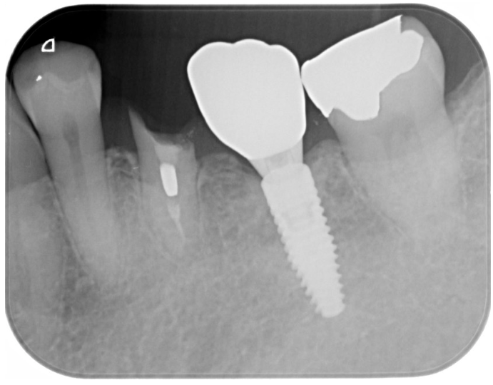 Before image