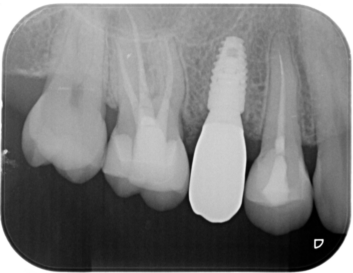 After image