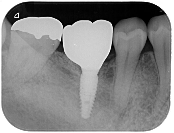 After image