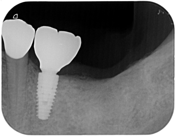 After image