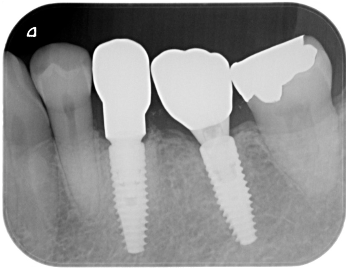 After image