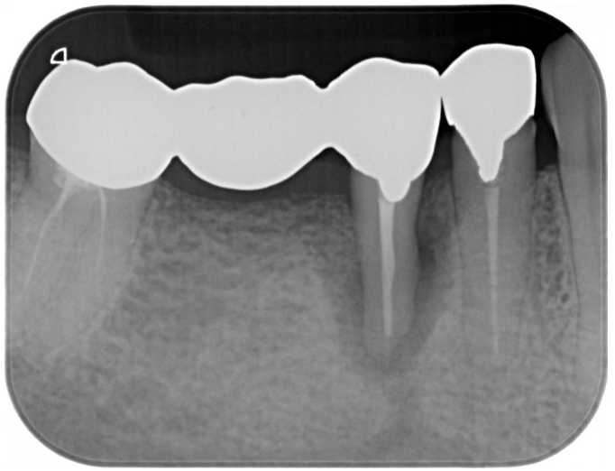 Before image