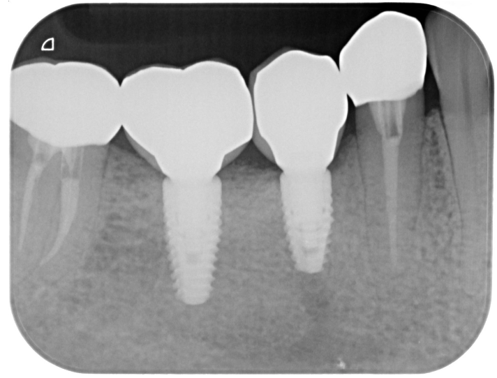 After image