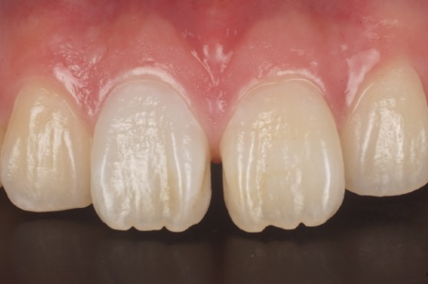 After image