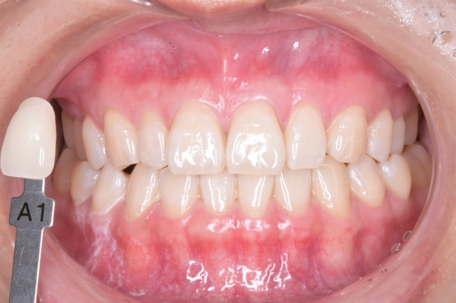 After image