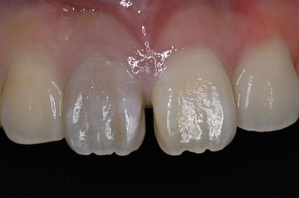 Before image