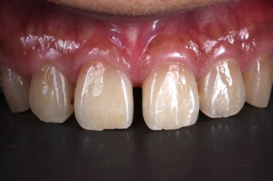 Before image