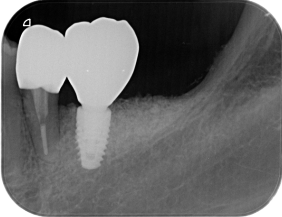 After image