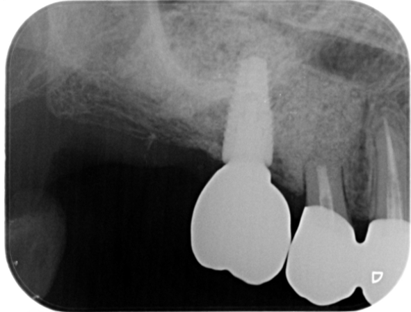 After image