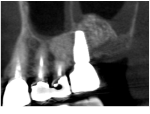 After image