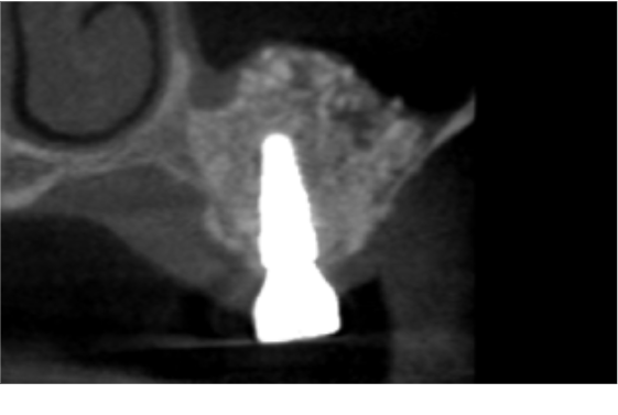 After image