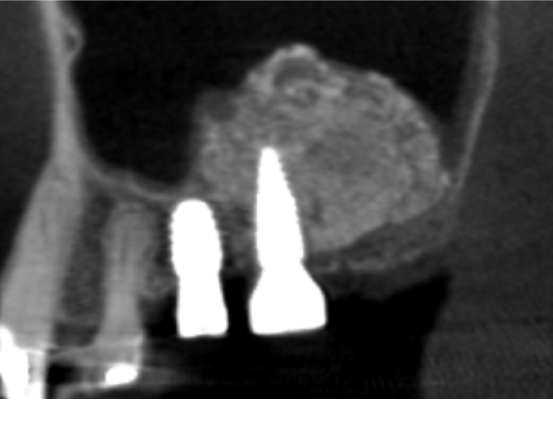 After image