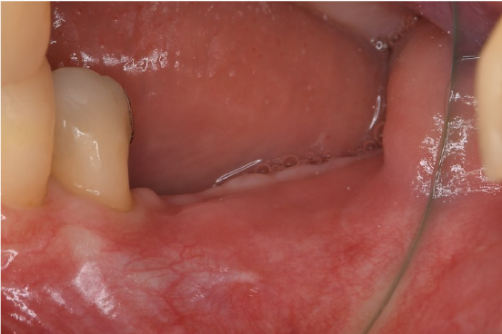 After image