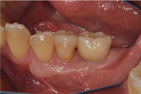 After image