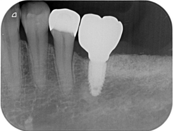 After image