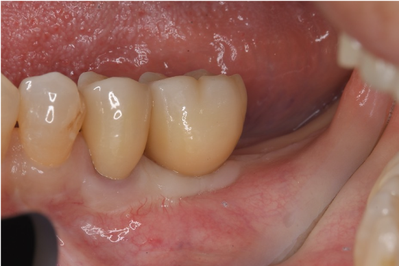 After image