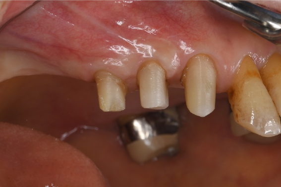 Before image