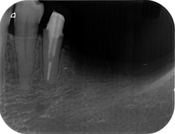 Before image