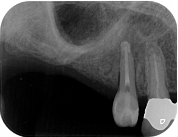 Before image