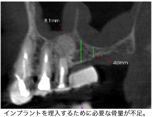 Before image