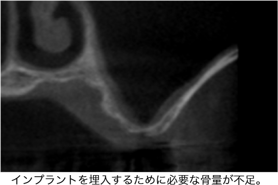 Before image