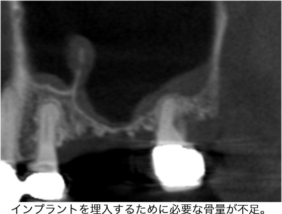Before image