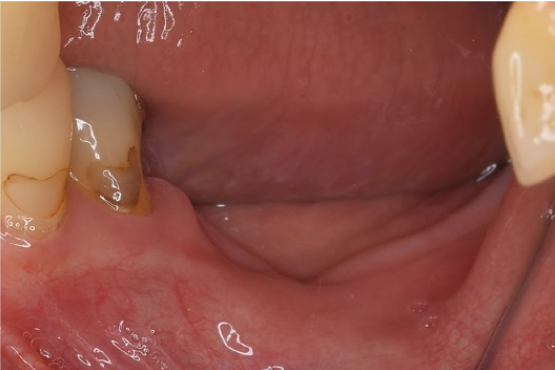 Before image