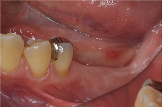 Before image