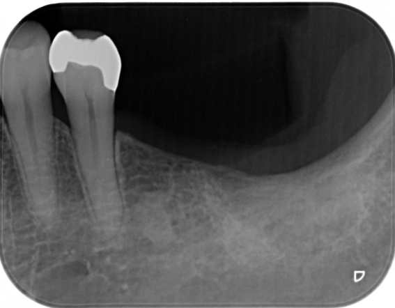Before image
