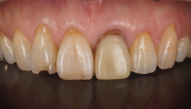 Before image