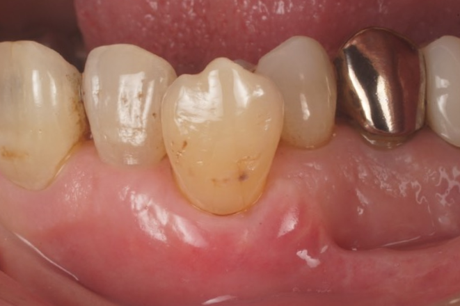 After image