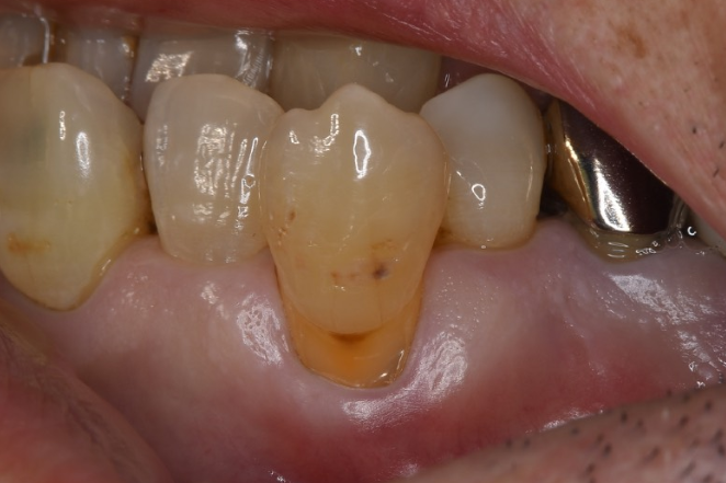 Before image
