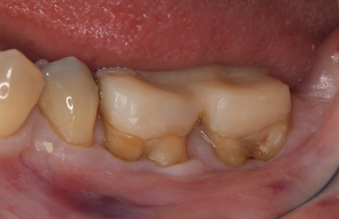 Before image
