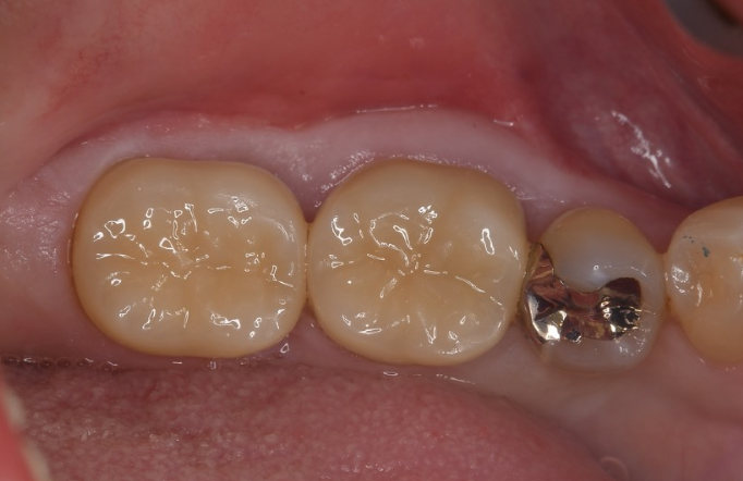 After image