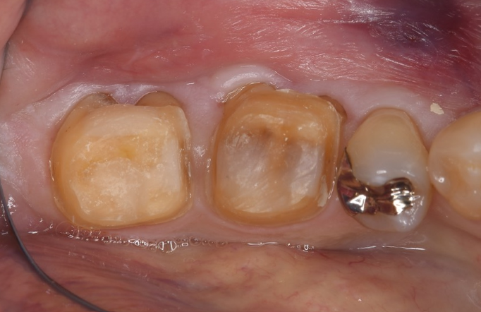 Before image