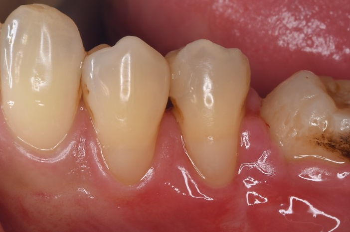 After image