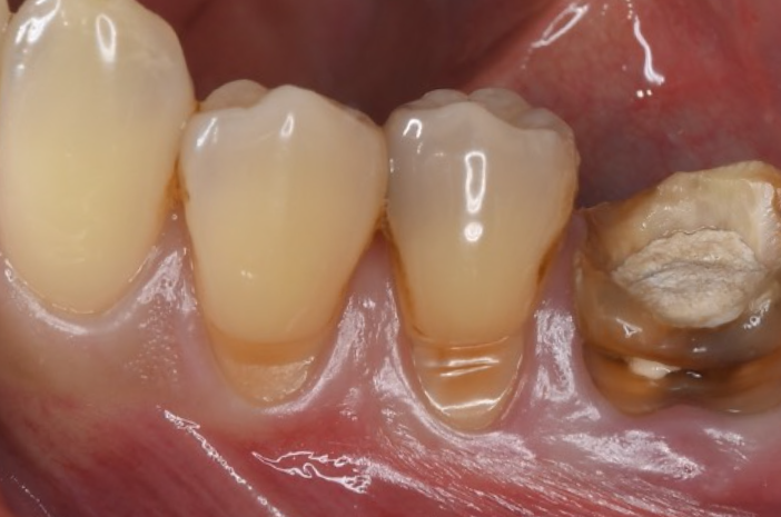 Before image