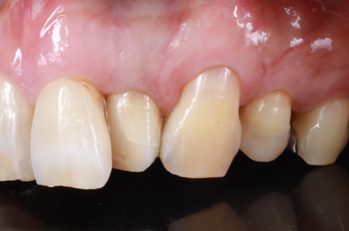 After image