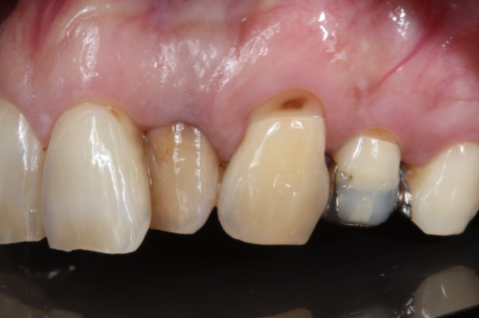 Before image